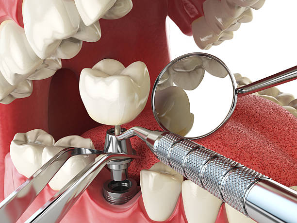 Best Emergency Care for Gum Disease in Agua Fria, NM